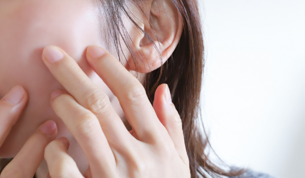 ニキビのホルモン療法